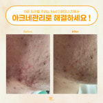 더맑은스킨 아산탕정역점