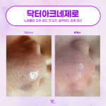 더맑은스킨 아산탕정역점