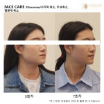미본 얼굴윤곽관리 강남점