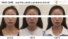 미본 얼굴윤곽관리 강남점