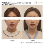 미본 얼굴윤곽관리 강남점