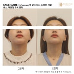 미본 얼굴윤곽관리 강남점