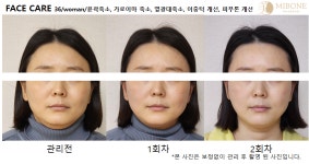 미본 얼굴윤곽관리 강남점
