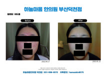 하늘마음한의원 부산덕천