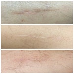 룩서스플라즈마라이너강서지사 | 룩서스플라즈마 강서지사