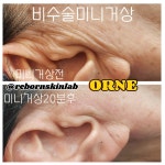 룩서스플라즈마라이너강서지사 | 룩서스플라즈마 강서지사