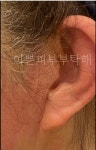룩서스플라즈마라이너강서지사 | 룩서스플라즈마 강서지사