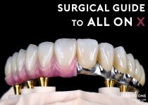 제로투원치과기공소