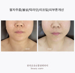 뷰티온유왁싱&눈썹&스킨케어미사역본점