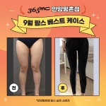 365mc의원 안양평촌점