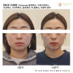 수뷰티&귀족다이어트