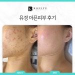 보니예에스테틱