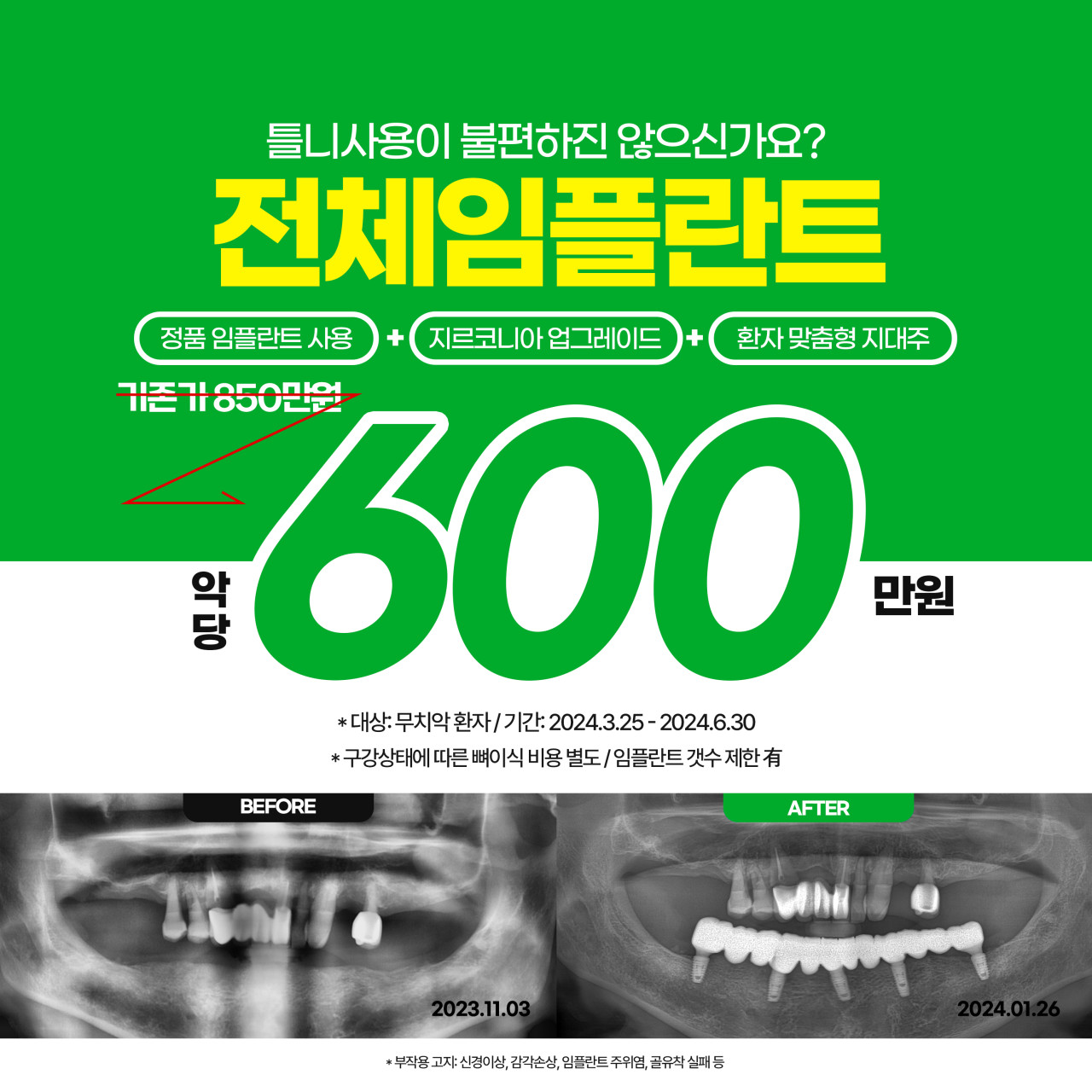 창원진해미소가득치과의원 광고