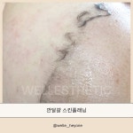 웰레스테틱 일산점