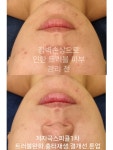 라비에 에스테틱