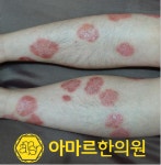 아마르한의원 하단점