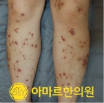 아마르한의원 하단점