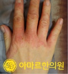 아마르한의원 하단점