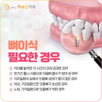 미소인치과의원