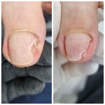 레푸스 방이역점