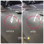 덴트스타