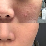 하베레피부전문센터