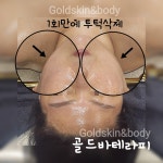 골드스킨앤바디