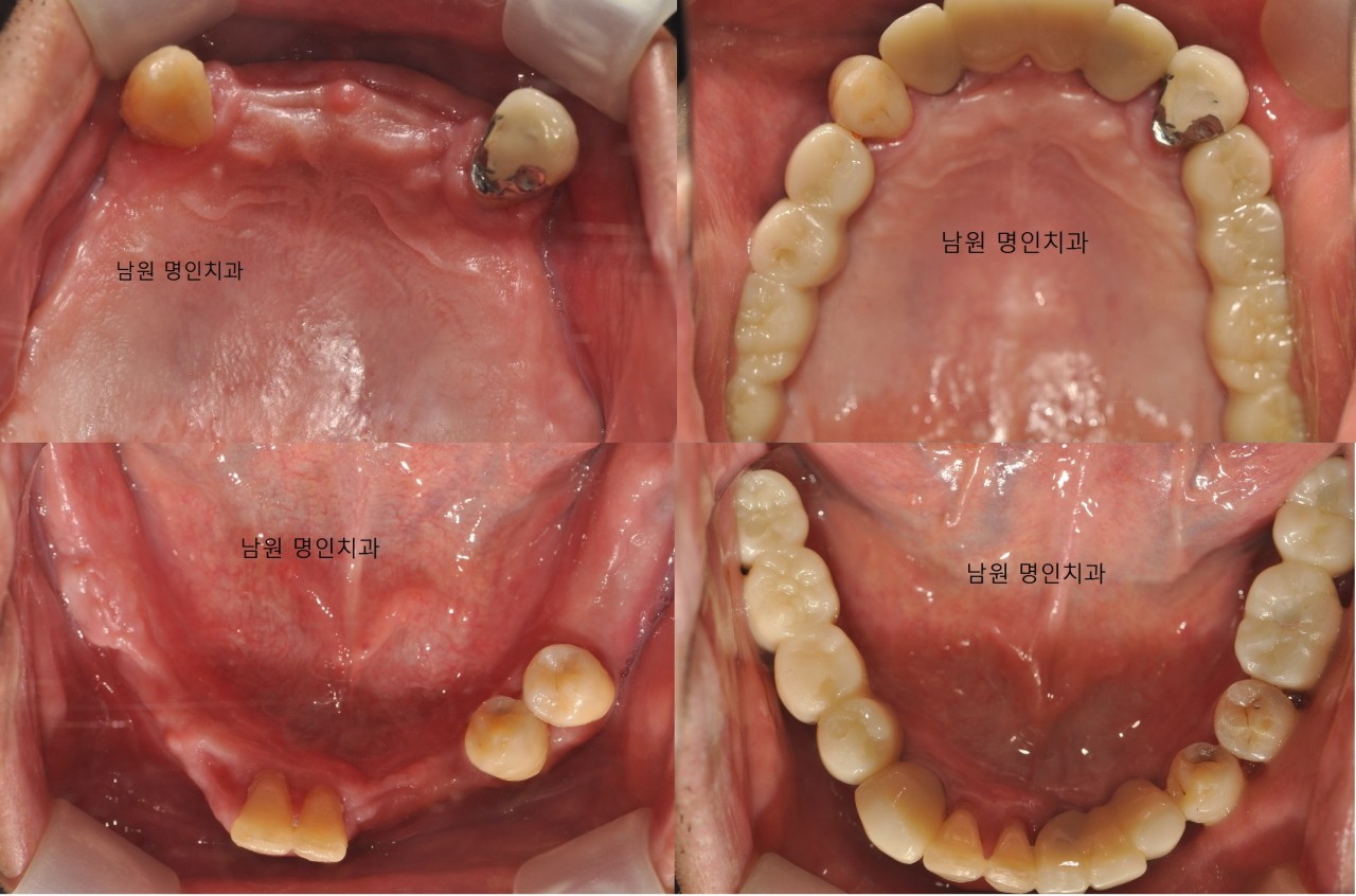 명인치과의원 광고