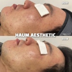 하움에스테틱