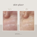 스킨플러스