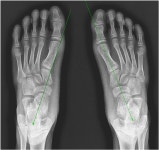 척편한재활의학과의원