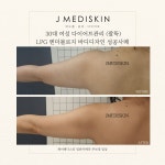 제이메디스킨