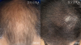 드보라메디컬코스메틱