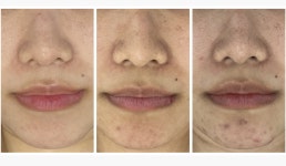 미더베스트 수원점