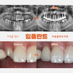 마음플란트치과의원