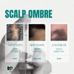 채우다아카데미 탈모커버&생장술&숱채움&눈썹커버&원형탈모