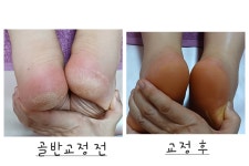 위더스산후케어민낯 | 위더스산후케어