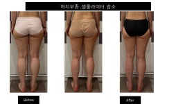 모비연