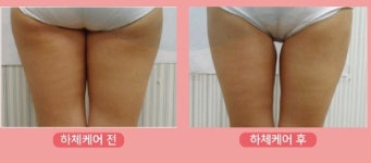 더어려지다에스테틱
