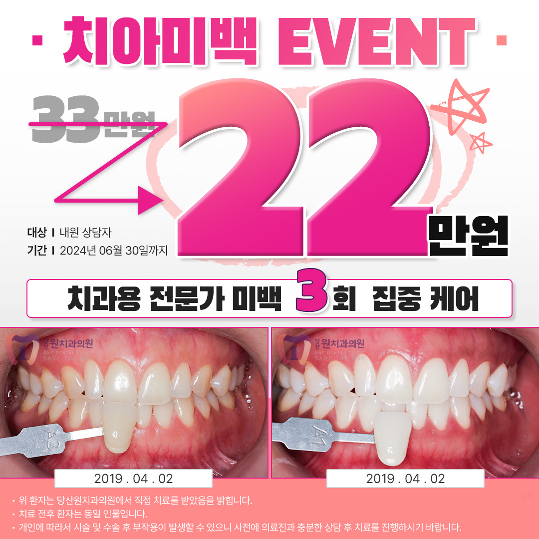 당산원치과의원 광고