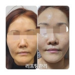 본스킨앤바디