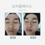 아나덴 슈가링왁싱 광주충장로점