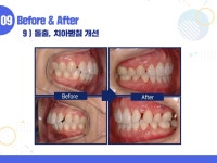 뉴미시간치과의원