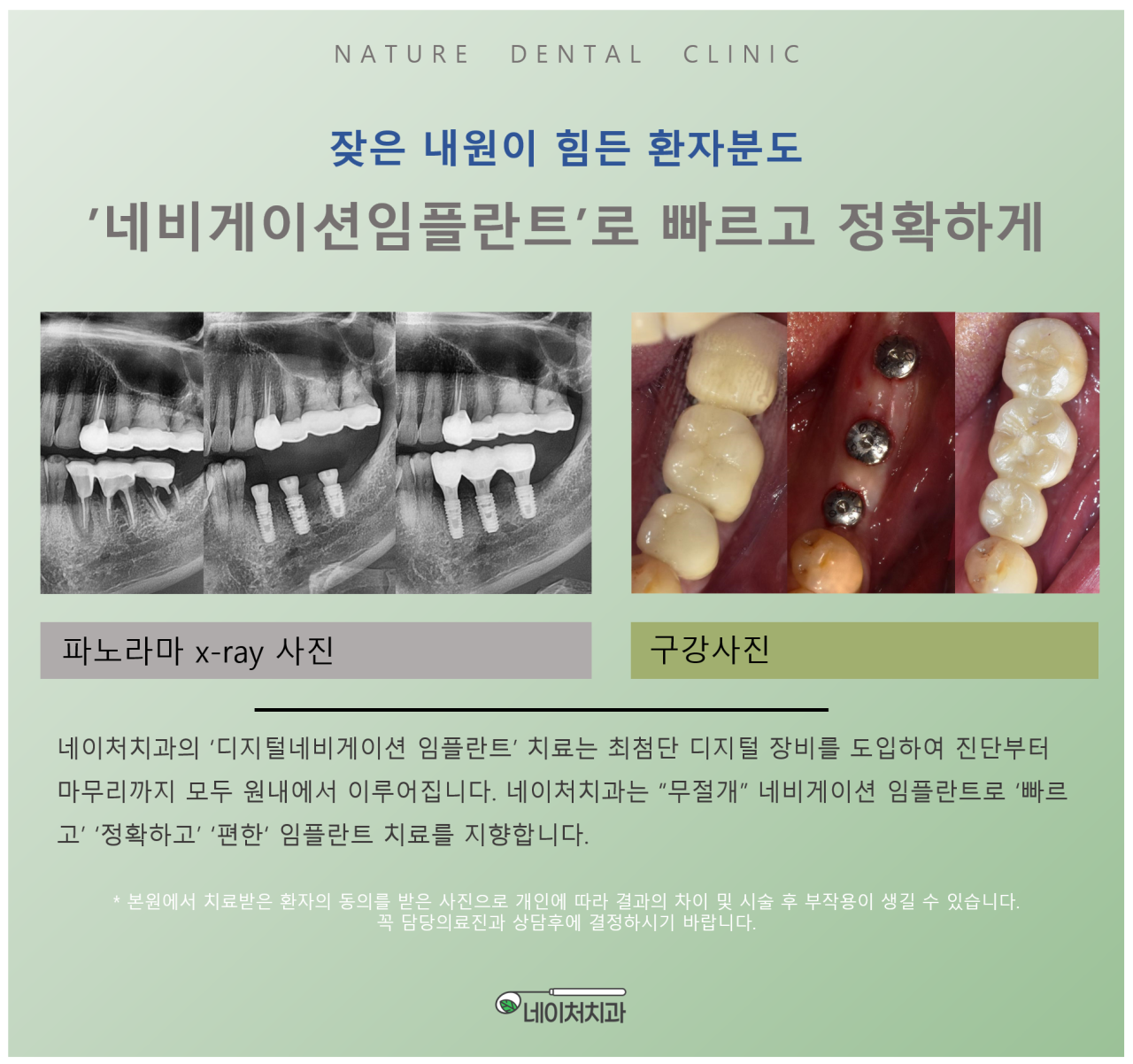네이처치과의원 광고