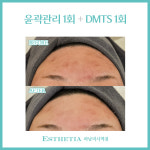 에스테티아 하남미사역점