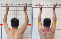 웰니스포유 청담 체형교정