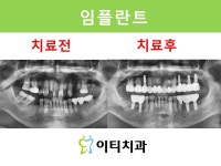 이티치과의원 부산