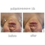 청담스킨케어