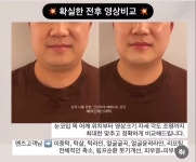 예라인에스테틱 광주본점