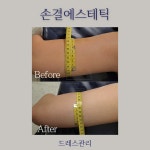 손결에스테틱